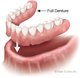 Dentures